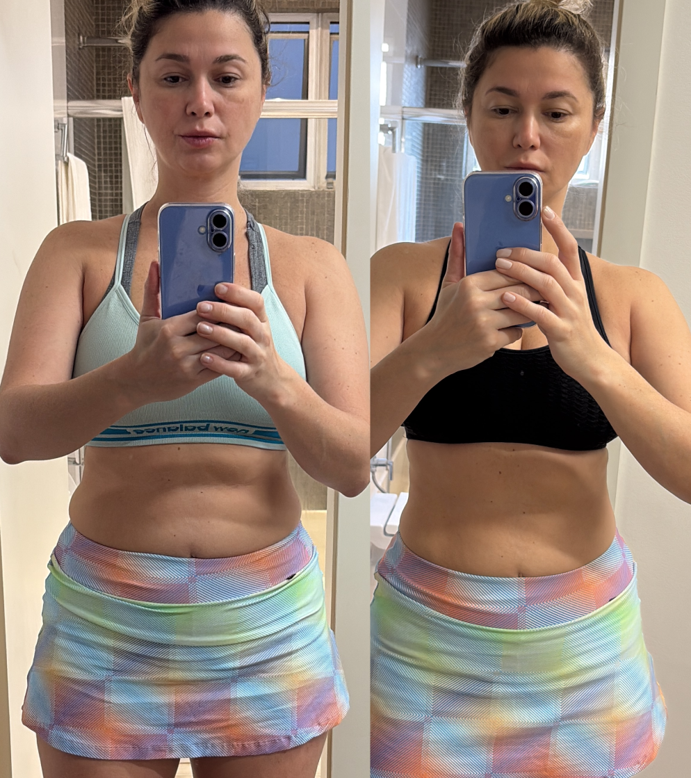 André Lucas Santiago - antes e depois