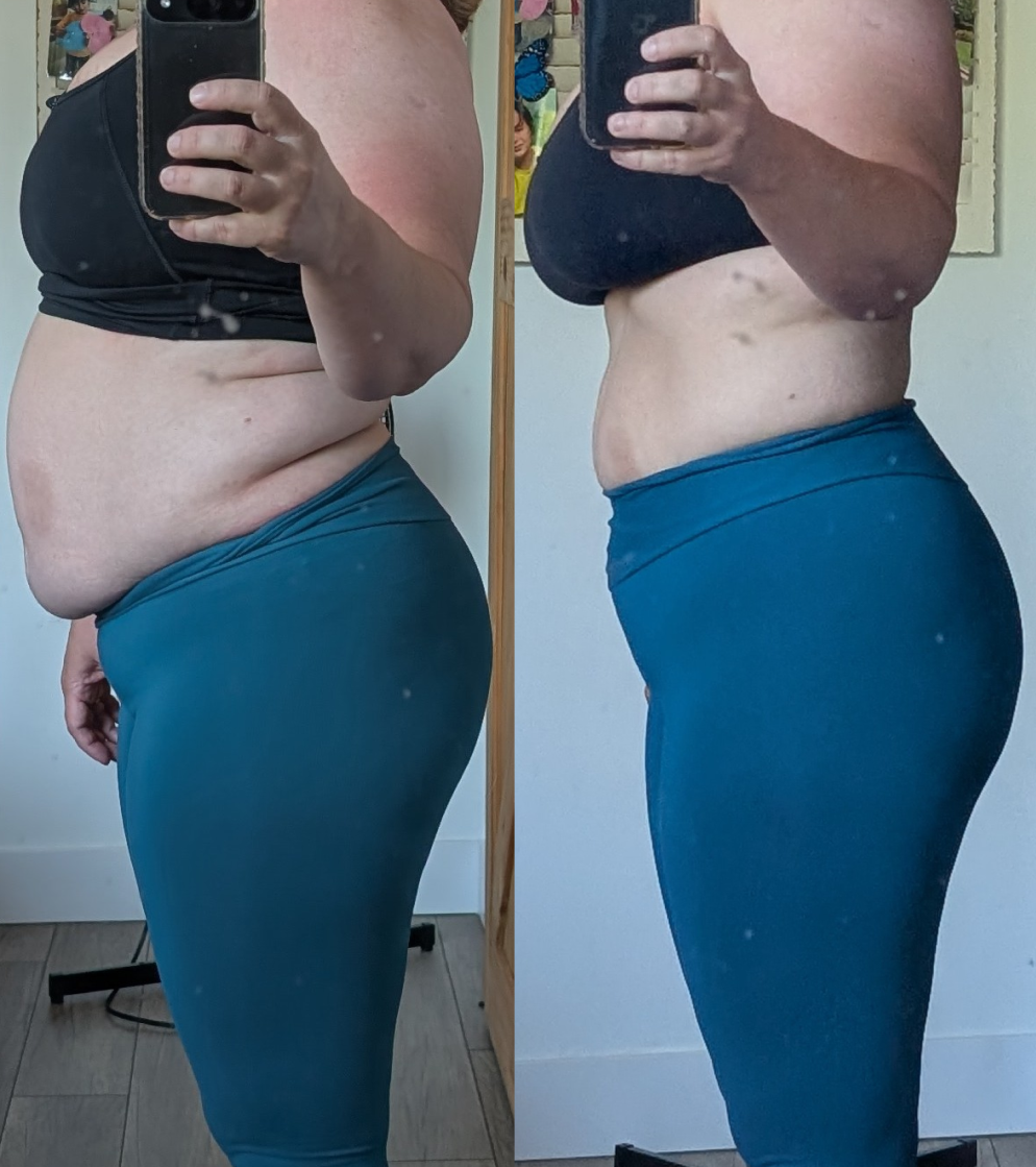 André Lucas Santiago - antes e depois