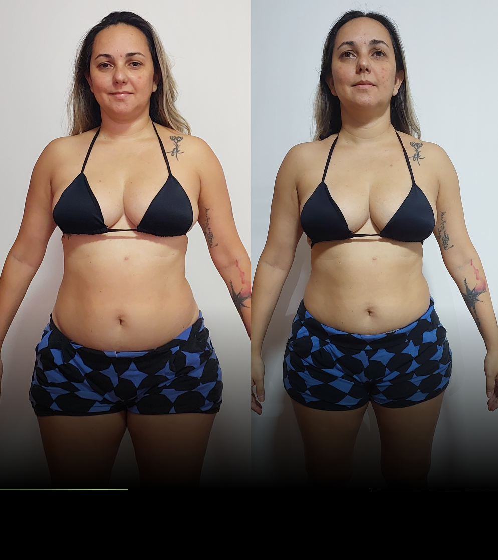 Camila Guerra - antes e depois