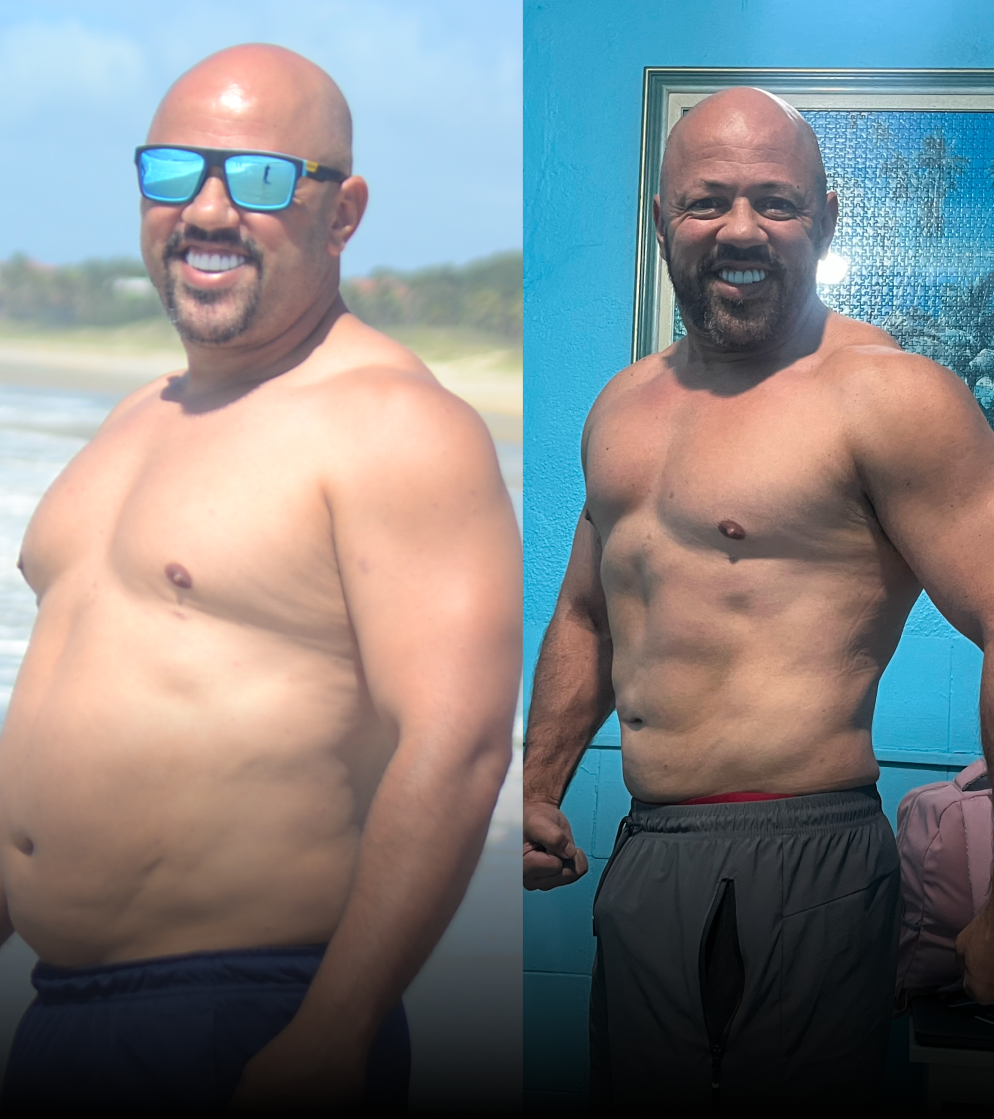 Denis Silva - antes e depois