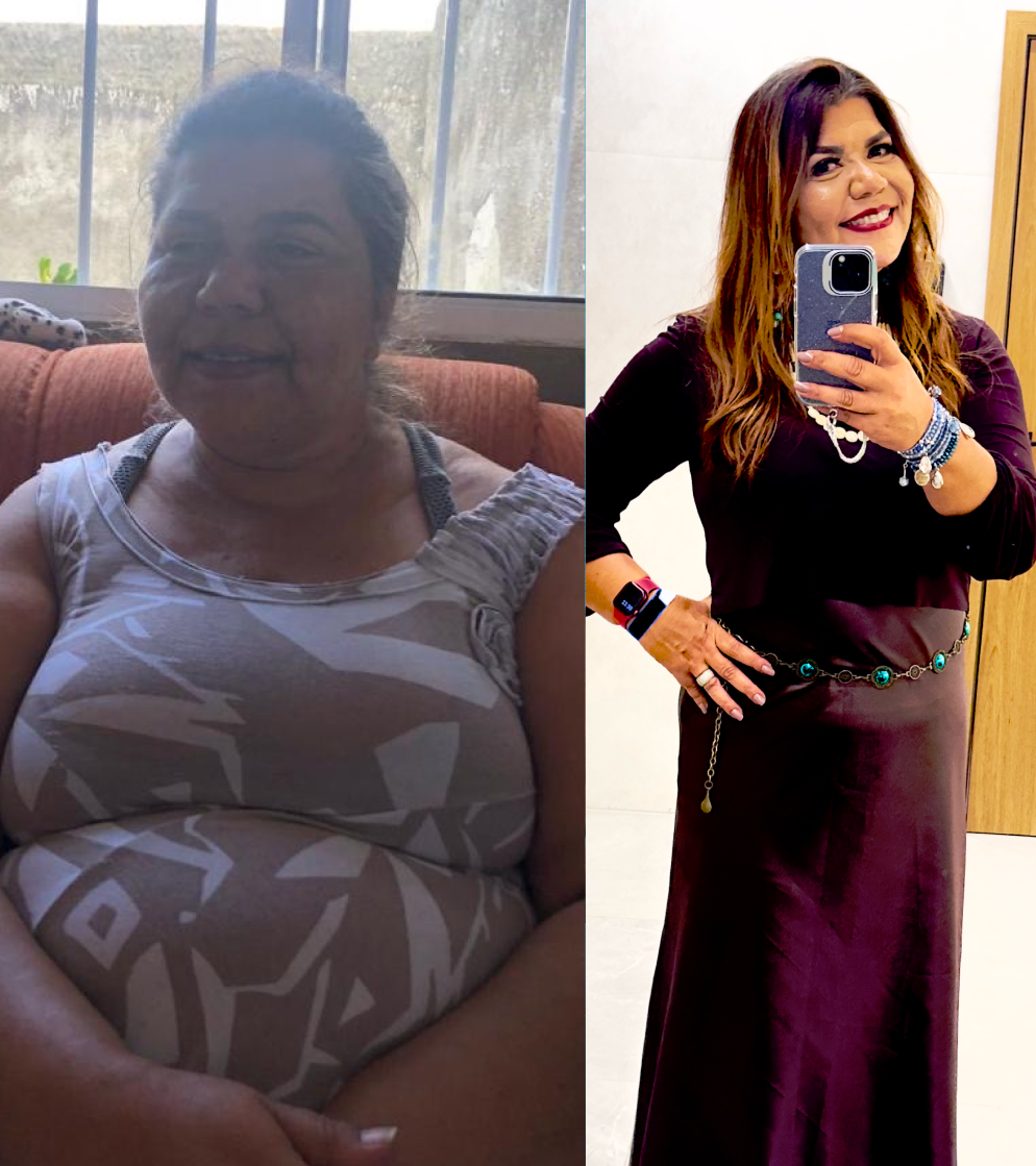 Denis Silva - antes e depois